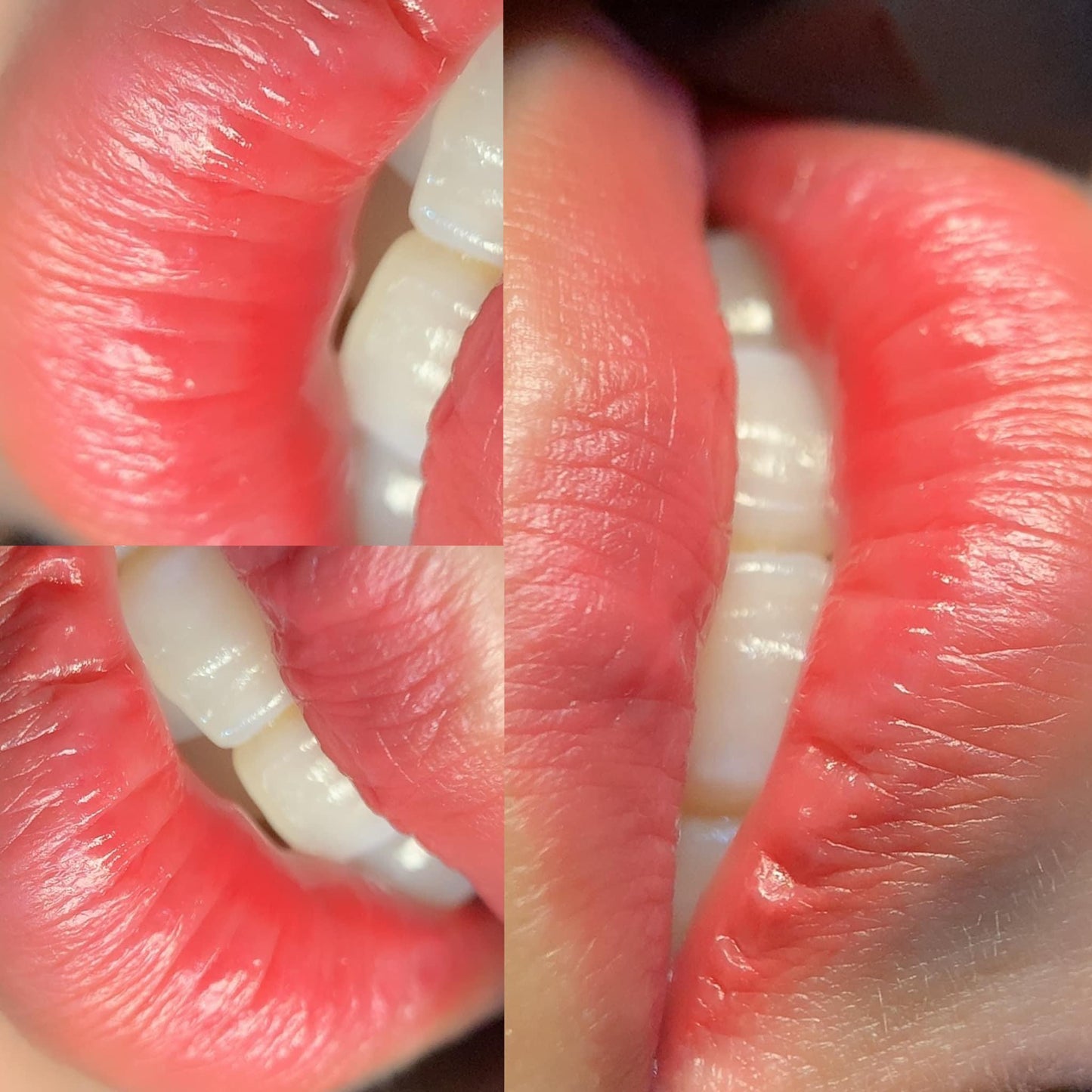 Peachy Lips - Môi Đào Gợi Cảm