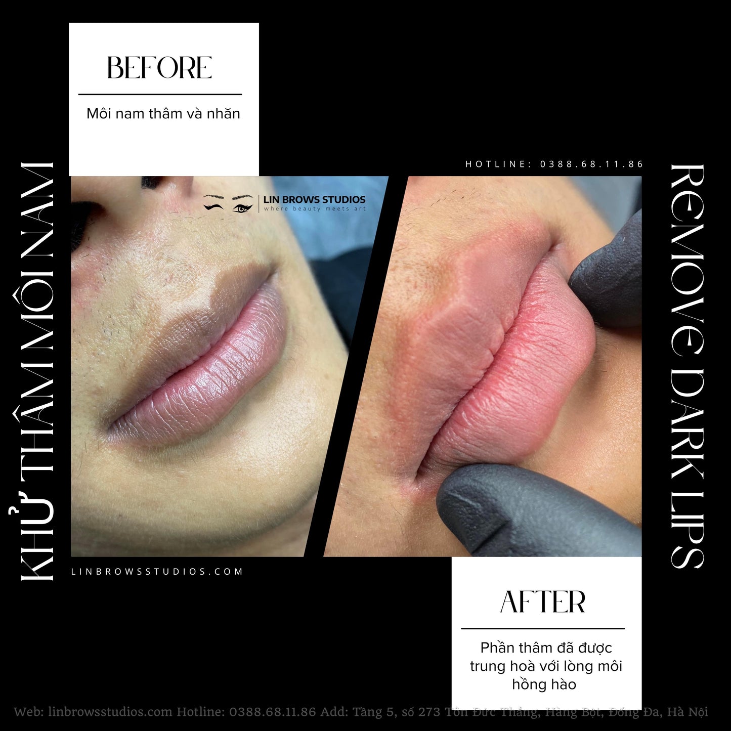 Peachy Lips - Môi Đào Gợi Cảm