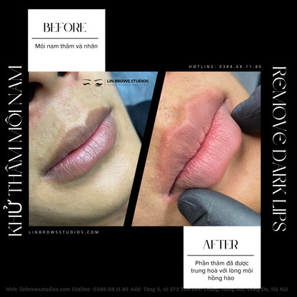 Peachy Lips - Môi Đào Gợi Cảm