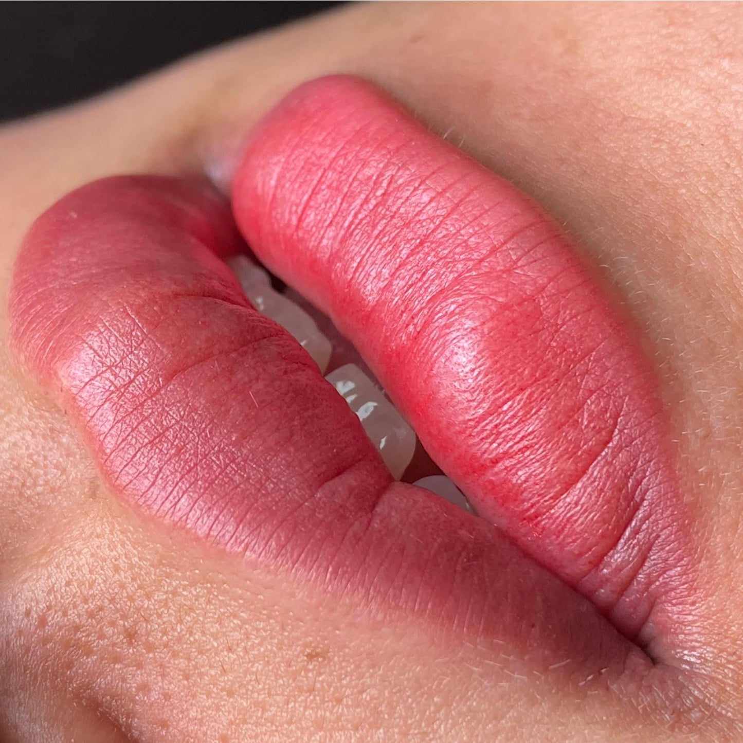 Peachy Lips - Môi Đào Gợi Cảm