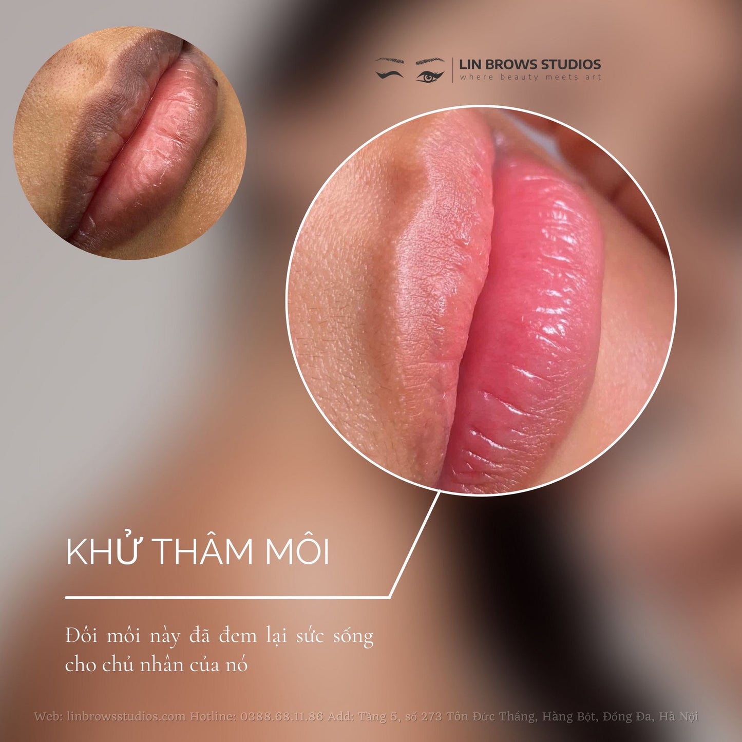 Peachy Lips - Môi Đào Gợi Cảm