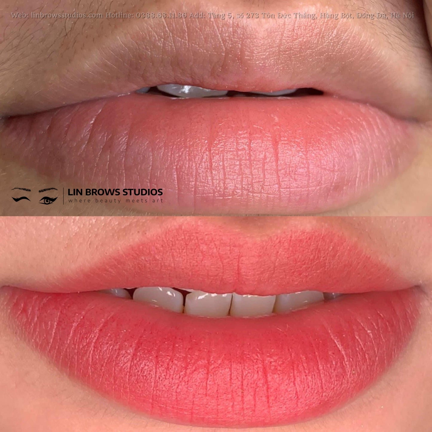 Peachy Lips - Môi Đào Gợi Cảm