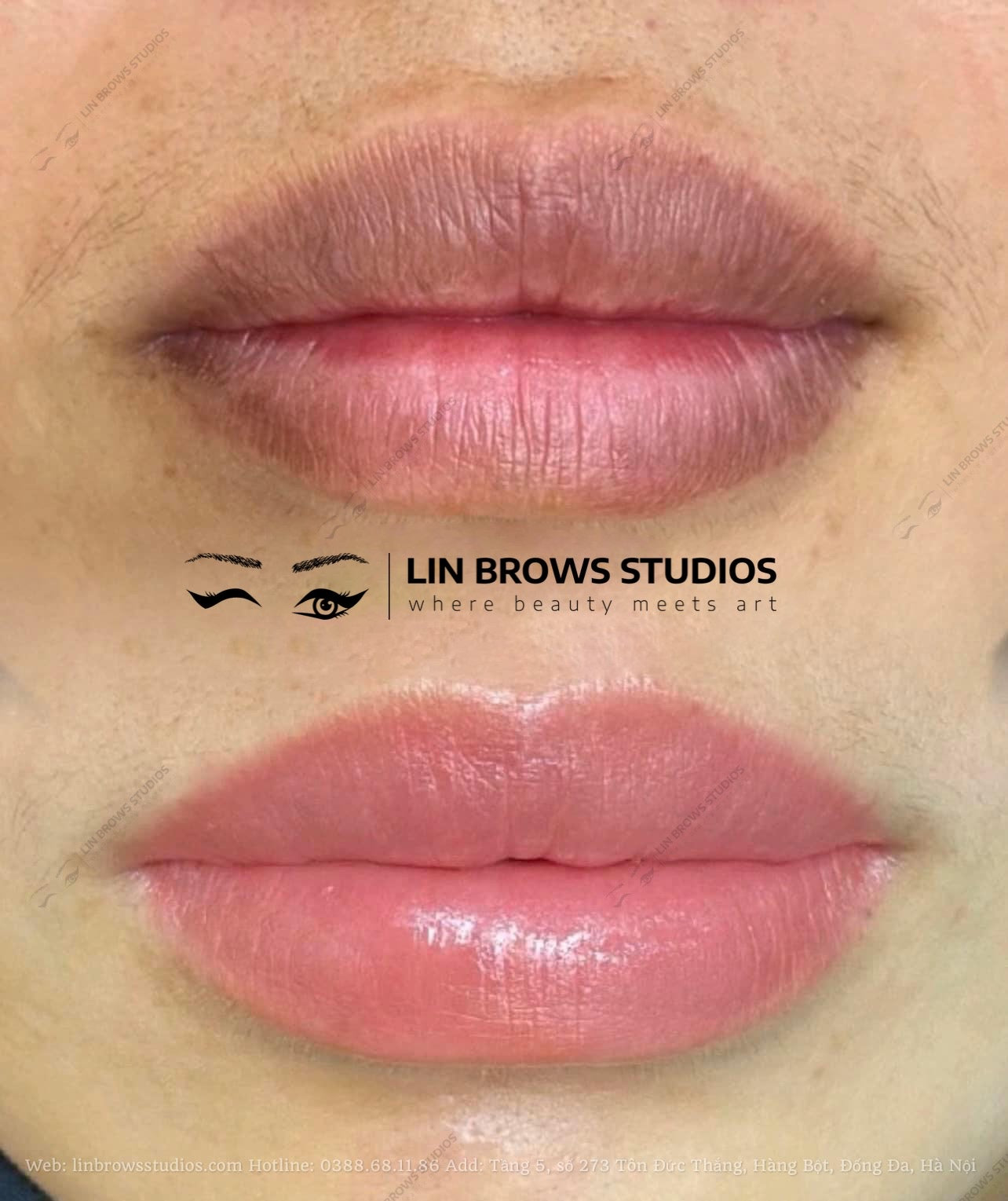 Peachy Lips - Môi Đào Gợi Cảm